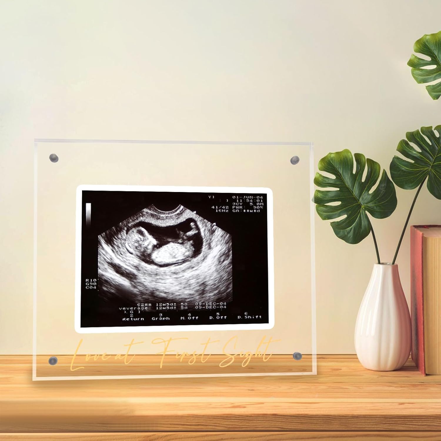Acrylic Ultrasound Picture Frame - Unique Baby Keepsake