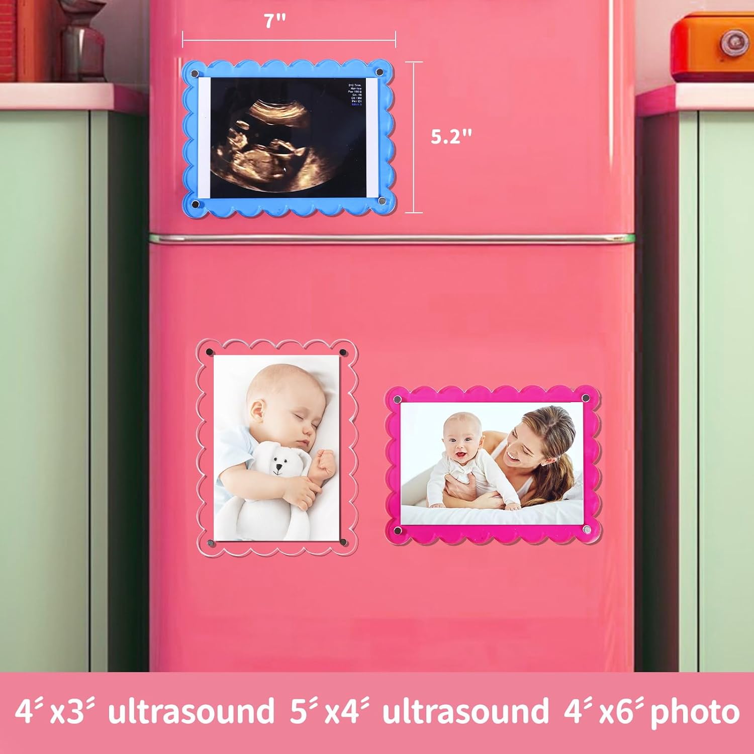 Magnetic Clear Acrylic Scalloped Ultrasound Frame - Pregnancy Announcement Display