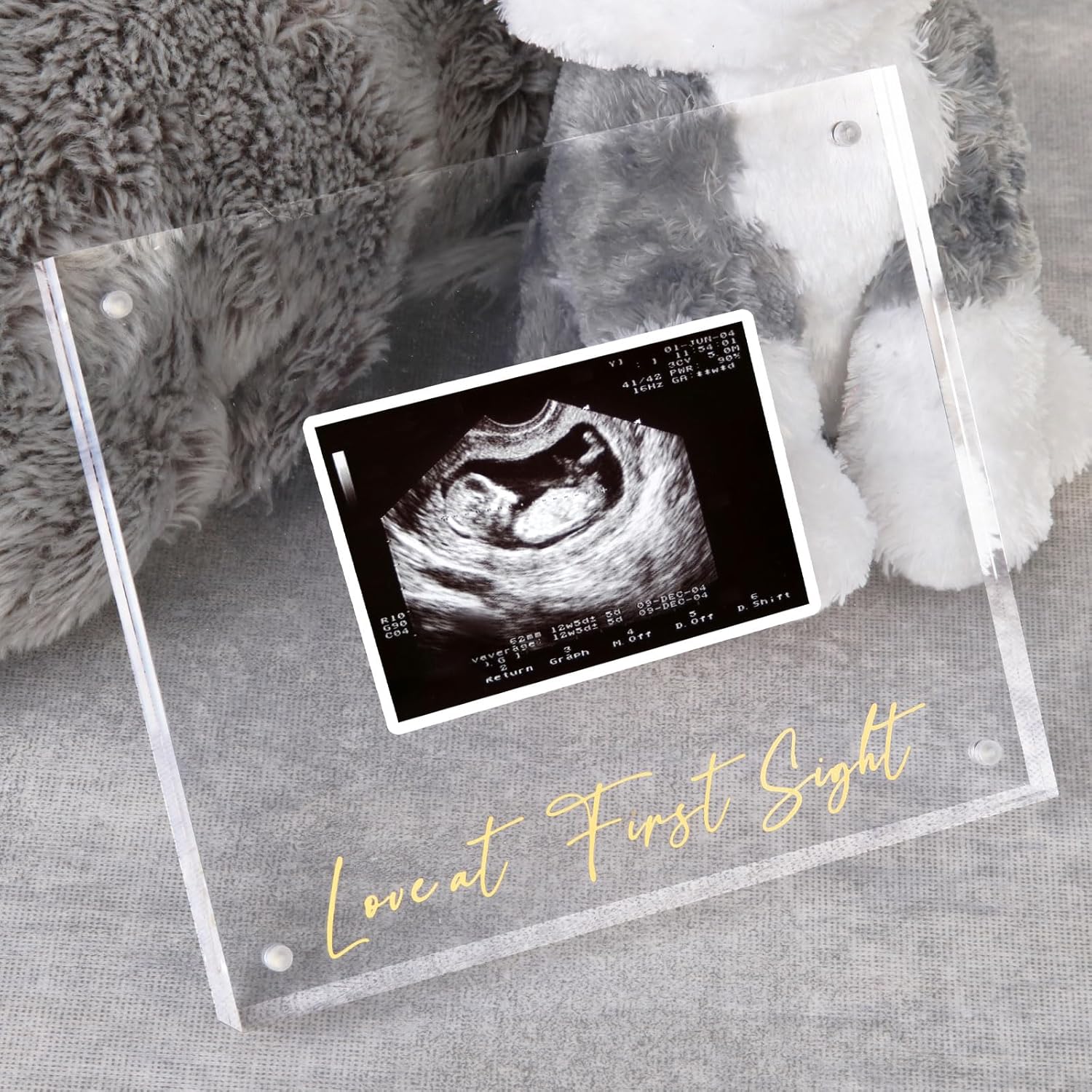 Acrylic Ultrasound Picture Frame - Unique Baby Keepsake
