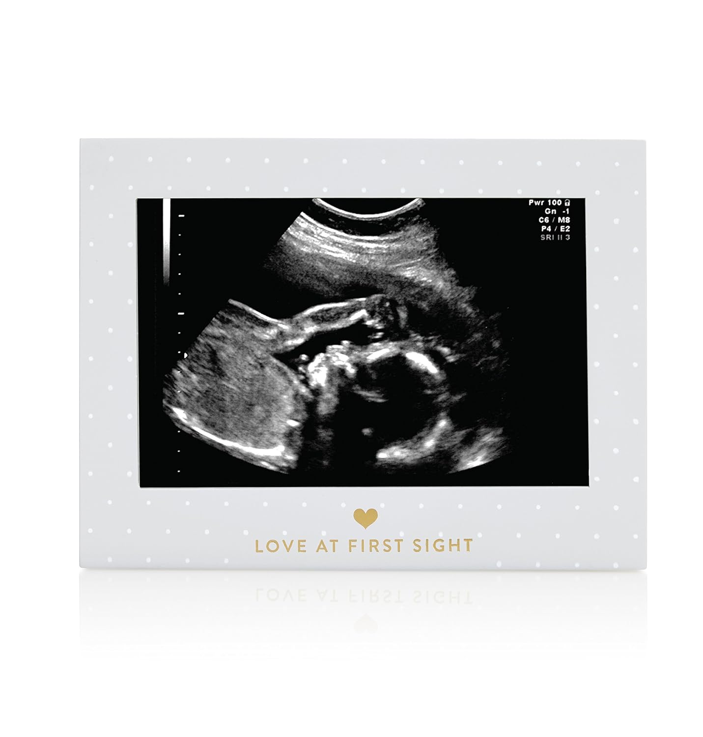 Little Blossoms Love At First Sight Sonogram Frame